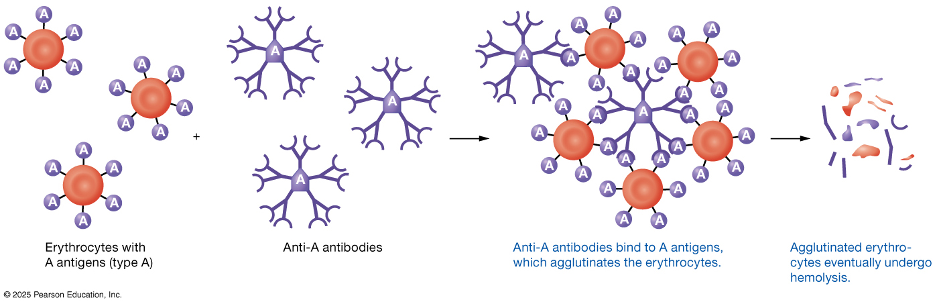 figure showing type A blood and agglutination and hemolysis