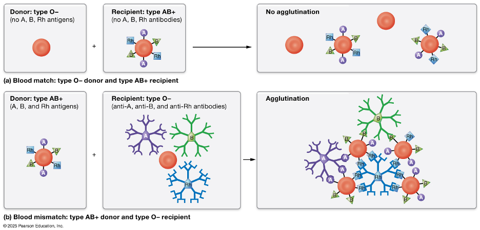 figure showing blood type mismatch with agglutination