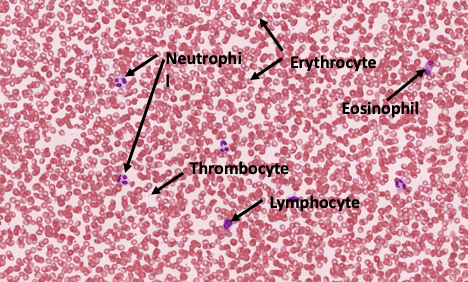 Histology slide of blood smaple with labeled formed elements