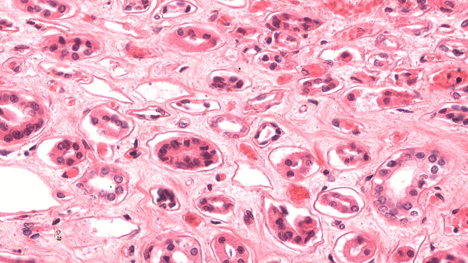 Histology of the renal medulla showing thin tubule cross-sections.
